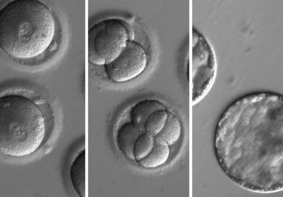 "Διορθώσεις" στο DNA ενός εμβρύου; Not impossible.