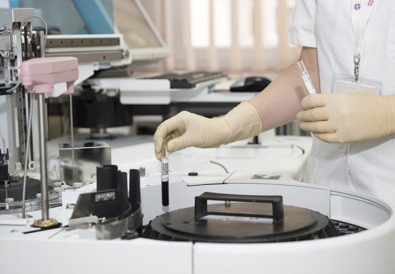 Νέο σύστημα τεχνητής νοημοσύνης κάνει ακριβείς διαγνώσεις καρκίνου του προστάτη