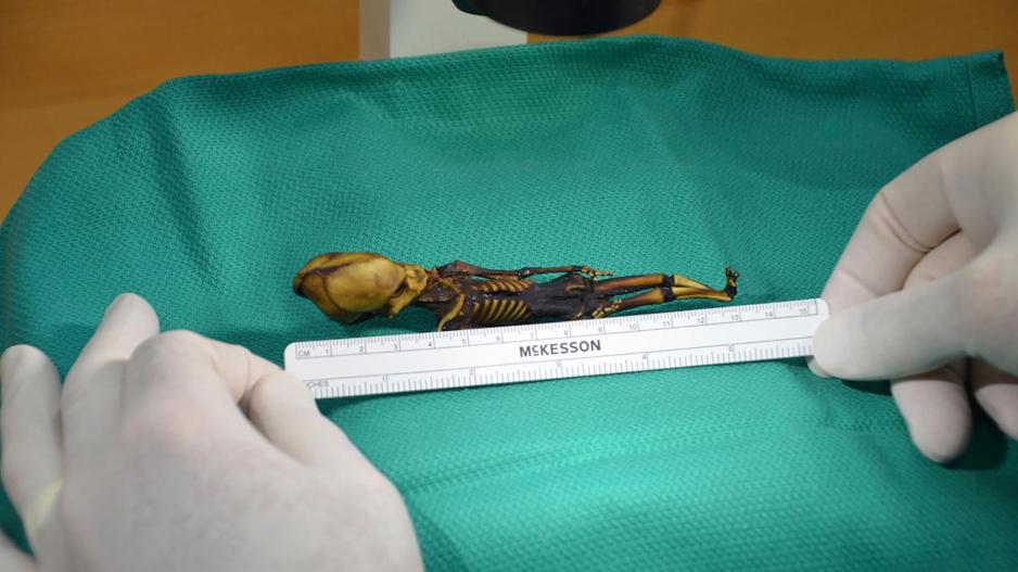 Ανθρώπινος τελικά ο ασυνήθιστος σκελετός που θύμιζε εξωγήινο