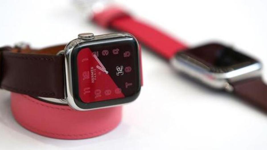 Apple Watch 4: Οι καρδιολόγοι ανησυχούν για τη νέα δυνατότητα του